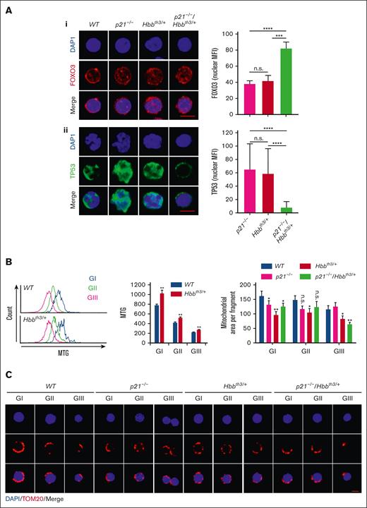 Modulation of FOXO3 and TP53 expression in p21−/−/Hbbth3/+ erythroid cells. (Ai) FOXO3 nuclear localization in erythroid progenitors from WT, p21−/−, Hbbth3/+, and p21−/−/Hbbth3/+ mice using confocal microscopy; analyses of at least 40 cells (quantification, right graph). Scale bar: 5 μm. (Aii) TP53 nuclear localization in erythroid progenitors from WT, p21−/−, Hbbth3/+, and p21−/−/Hbbth3/+ mice using confocal microscopy; analyses of at least 40 cells (quantification, right graph). Scale bar: 5 μm. (B) Histograms of Mitotracker Green staining of TER119+ cells in different gates (left) and quantification (right). (C) Mitochondrial morphology in erythroid progenitors from WT, p21−/−, Hbbth3/+, and p21−/−/Hbbth3/+ mice using confocal microscopy; analyses of at least 30 cells. Scale bar: 5 μm. Quantification of mitochondrial area (top). Results are shown as mean ± standard error of the mean; ∗P < .05; ∗∗P < .01; ∗∗∗P < .001; ∗∗∗∗P < .0001; and n.s., not significant.