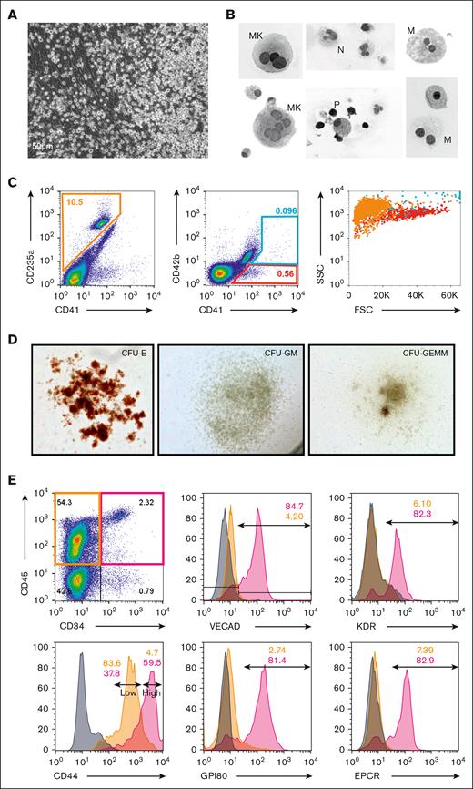 Human fetal-lung explants undergo EHT to produce HSPCs. (A) Image of a human fetal-lung explant culture showing a robust population of floating hematopoietic cells against a background of adherent cells. (B) Cytospin of human fetal lung suspension cells. (C) Flow cytometric assessment of differentiated erythrocyte and megakaryocyte populations. (D) Images of representative colonies from a colony-forming unit assay. (E) Assessment of pre-HSC and EHT markers on CD34+/CD45+–defined progenitors vs CD34–/CD45+–differentiated hematopoietic cells.