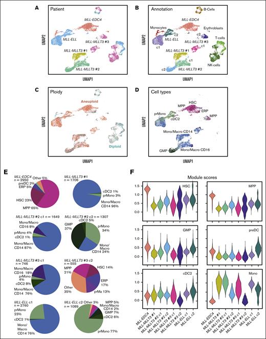 Intratumor heterogeneity and cell type assignment of MLL-r samples. (A) UMAP embedding of all AML samples colored by patient. (B) UMAP embedding colored by cell types determined from marker gene expression. AML cells form separate clusters for each patient whereas nonmalignant cell types from different samples cluster together. (C) UMAP embedding colored by ploidy with AML cells annotated as aneuploid (red) and microenvironment cells as diploid (cyan). (D) UMAP embedding of AML cells colored by cell type prediction with the SingleR annotation software package against the Human Cell Atlas as reference data set. (E) Pie charts of predicted cell type composition for AML cell clusters. (F) Violin plots of myeloid cell signature module scores according to supplemental Table 2 for AML cell clusters. c1, cluster1; and c2, cluster2.