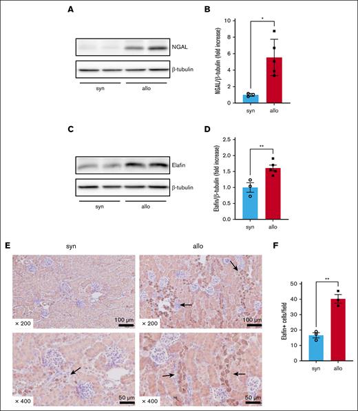 Alloimmune-mediated renal tissue damage was increased in allo recipients. BALB/c animals were lethally irradiated and received transplantation with CD90.2+ splenic T cells together with BM cells from either syn BALB/c or allo MHC-mismatched B6 donors. Kidneys were harvested on day 14 after HCT to investigate the expression of NGAL and elafin in whole-kidney lysates, and immunohistochemically stained for elafin. (A) Representative western blot image of NGAL is shown. (B) Quantification of NGAL protein level is shown. (C) Representative western blot image of elafin is shown. (D) Quantification of elafin protein level is shown. (E-F) Representative images (E) and quantification (F) of immunohistochemical staining for elafin are shown. Arrows highlight elafin-positive cells. Elafin staining was positive mainly in distal tubular epithelial cells. Magnifications are shown in the figures in panel E. The number of elafin-positive cells per 200× original magnification field was higher in the kidneys of allo mice than in those of syn mice in panel F. n = 3 to 5 mice per group. The data are representative of 2 experiments. The bars show the mean ± SEM. Student t test was used for statistical analysis for panels B,D,F.
