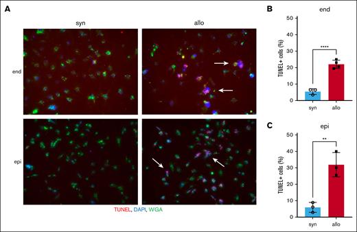 Allo donor T cells directly attack renal cells. Splenic effector T cells from either syn BALB/c or allo B6 mice were activated by coculturing with irradiated whole splenocytes from BALB/c mice for 6 days. Target BALB/c-derived renal endothelial cells (end) or proximal tubular epithelial cells (epi) were cocultured with these activated effector T cells for 4 hours. Target cell apoptosis was detected by TUNEL assay. (A) Representative TUNEL-stained images of renal endothelial cells (top) and proximal tubular epithelial cells (bottom) are shown. Arrows highlight TUNEL-positive cells. TUNEL, red; DAPI, blue; wheat germ agglutinin (WGA), green. (B-C) The proportion of TUNEL-positive cells among renal endothelial cells (B) and proximal tubular epithelial cells (C) is shown; n = 3 to 4 mice per group. The bars show the mean ± SEM. Student t test was used for statistical analysis in panels B-C.