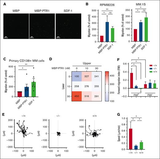 HAPLN1-PTR1 induces chemotactic and chemokinetic migration in MM cells. (A) Microscopic images of RPMI8226 cells on transwell membranes that had migrated from the upper chamber to the lower chamber containing MBP or MBP-PTR1 at 100 nM or SDF-1 at 30 nM after 16 hours. (B) Graphs depicting percentage migration of RPMI8226 and MM.1S MM cells treated as in panel A with MBP control being set as 100%. (C) Graphs depicting percentage migration of CD138+ primary MM cells isolated from 6 patients in response to MBP, MBP-PTR1, or SDF-1 with MBP control being set as 100%. (D) Migration of RPMI8226 cells in response to indicated MBP-PTR1 concentrations in the upper and lower chambers were quantified with the control (0 nM) set at 100%. (E) Individual cell track trajectories of 3 groups in time-lapse μ-slide migration assay using RPMI8226 cells recorded for 16 hours are shown: positive gradient (−/+; 30 nM MBP/MBP-PTR1), negative control (−/−; 30 nM MBP/MBP), and no gradient (+/+; 30 nM MBP-PTR1/MBP-PTR1). The y-axis is parallel to the chemotactic gradient in which cell trajectory going up along the y-axis is the migration toward the MBP-PTR1 in the positive-gradient group. (F) Graphs showing the comparison of averaged FMIII and FMI⊥ for each group from panel E. (G) Graph showing the comparison of the cell speed from panel E. All experiments were independently repeated 3 times for panel D and 4 times for panels B,E-G. Data are expressed as means ± standard error of the mean (SEM). ∗P < .05; ∗∗P < .01; ns, not significant.