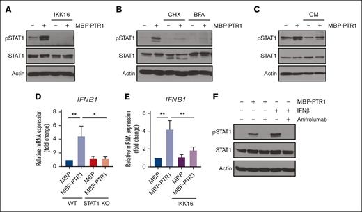 Autocrine/paracrine production of IFN-β by NF-κB contributes to HAPLN1 matrikine–induced STAT1 activation. (A) Representative western blot analysis of indicated proteins in RPMI8226 cells pretreated with IKK16 (10 μM) or dimethyl sulfoxide (DMSO) for 10 minutes and stimulated with 100 nM of MBP or MBP-PTR1 for 6 hours. (B) Representative western blot analysis of indicated proteins in RPMI8226 cells pretreated for 10 minutes with cycloheximide (CHX; 20 μg/mL) or brefeldin A (BFA; 3 μg/mL) and stimulated with 100 nM of MBP or MBP-PTR1 for 6 hours. (C) RPMI8226 cells were stimulated with 100 nM of MBP or MBP-PTR1 for 6 hours (lane 1 and 2). RPMI8226 cells were stimulated with 100 nM of MBP or MBP-PTR1 for 5 hours and subsequently washed with fresh media. Conditioned medium (CM) was harvested after a 1-hour incubation of fresh media without MBP or MBP-PTR1. CM was added to fresh RPMI8226 cells for 15 minutes (lane 3 and 4) and analyzed using western blotting for the indicated proteins. (D) RPMI8226 (WT and STAT1 KO) cells were stimulated with 100 nM of MBP or MBP-PTR1 for 6 hours. The IFNB1 mRNA level was quantified using qRT-PCR and normalized to GAPDH and fold change relative to control (MBP in WT cells) was plotted. (E) RPMI8226 cells were treated as in panel A. The mRNA level of IFNB1 was quantified using qRT-PCR and normalized to GAPDH and fold change relative to control (MBP and DMSO treated cells) was plotted. (F) Representative western blot analysis of indicated proteins in RPMI8226 cells pretreated with 10 μg/mL of anifrolumab or human immunoglobulin G (IgG) for 10 minutes and stimulated with 100 nM of MBP or MBP-PTR1 for 6 hours or IFN-β (50 pg/mL) for 15 minutes. The graph represents the means ± SEM of 3 biological replicates for panels D-E, each performed in duplicates. ∗P < .05, ∗∗P < .01.