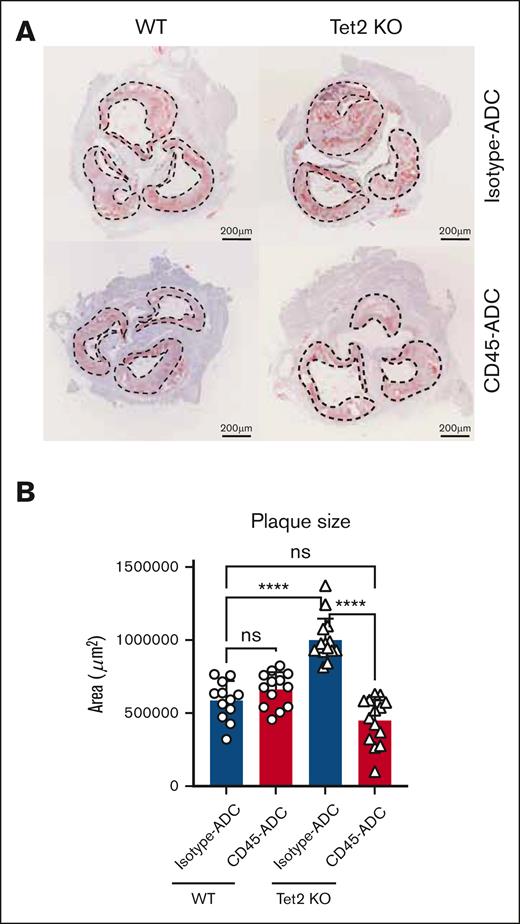 CD45-ADC and HSCT reducces aortic root plaque burden in clonal hematopoiesis driven atherosclerosis. (A) Oil-red-O images of aortic roots, 6 weeks after CD45-ADC treatment, and CD45.1+ HSCT in Ldlr KO mice with either WT or Tet2 KO bone marrow. Dashed lines outline atherosclerotic plaque surface area. Scale bar, 200 μm. (B) Quantification of aortic root atherosclerotic lesion surface area, 6 weeks after CD45-ADC treatment, and CD45.1+ HSCT in Ldlr KO mice with either WT or Tet2 KO bone marrow.