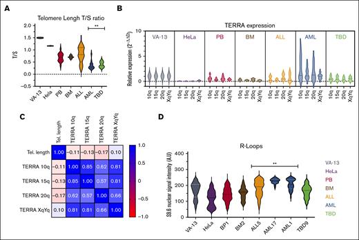 TERRA is constitutively expressed in low levels in patients with TBD, patients with ALL, and healthy donors. Patients with AML present a distinct pattern. (A) Violin plots of telomere length in the initial cohort. The patients with AML and TBD demonstrated the shortest telomere repeat copy number/single gene copy number (T/S) ratios compared with the BM and PB controls. (B) Violin plot of TERRA expression in the initial cohort. Patients with ALL and TBD demonstrate a similar level of TERRA expression compared with the BM and PB controls. (C) Spearman correlation matrix of TERRA 10q, 15q, 20q, XqYq, and telomere length among all cases included. TERRA expression is not upregulated by telomere shortening (P > .05). (D) Violin plot of R-loops in 8 samples. AML and ALL demonstrated high R-loops compared with the BM and PB controls.