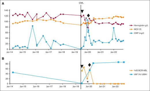 Correlation of blood count, C-reactive peptide, and molecular markers. (A) Hemoglobin count (g/L), mean corpuscular volume MCV (fl), and c-reactive peptide CRP (mg/L) from April 2014 to August 2022. Line, June 2019 CML diagnosis. (B) UBA1 variant p.Met41Val allele burden (variant allele frequency %) from April 2014 to August 2022 and BCR-ABL:ABL1 ratios (International Scale (IS) %) from June 2019 to August 2022. Line, CML diagnosis in June 2019; ▼ imatinib initiation in July 2019; ∗ imatinib withdrawal in November 2019; ♦ nilotinib initiation in February 2020.