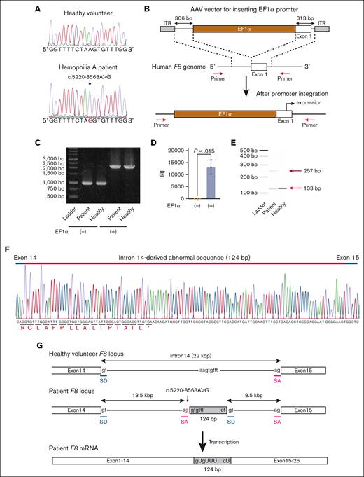 The expression of aberrant F8 transcripts in patient-derived iPSCs by insertion of the EF1α promoter. (A) DNA sequencing (a part of F8 intron 14) of iPSCs derived from a healthy volunteer and the patient with hemophilia A. The red nucleotide represents the variant. (B-F) Healthy donor and patient-derived iPSCs were treated with the SpCas9 RNP, and the AAV vector harboring the EF1α promoter with homology arms, and then single clones were isolated. (B) Experimental scheme for inserting the EF1α promoter before the transcriptional start site of F8. The red arrows indicate the primers used to confirm the insertion. (C) The insertion of the EF1α promoter was confirmed by PCR in an isolated clone. (D) Relative F8 mRNA expression assessed by quantitative reverse transcription (RT) PCR in healthy volunteer–derived iPSCs without or with the insertion of the EF1α promoter. Values represent the mean ± standard deviation (n = 3). Statistical analysis was performed by two-tailed Student t test. (E-F) Identification of aberrant F8 transcripts between exons 14 and 15 by RT-PCR in patient-derived iPSCs with insertion of the EF1α promoter. (E) The transcript between exons 14 and 15 assessed by microchip gel electrophoresis. The red arrows indicate the size of the amplicons. (F) Sequencing of the aberrant F8 transcript between exons 14 and 15 from patient-derived iPSCs. Additional sequences (124 bp) were inserted between exons 14 and 15. (G) Hypothesis for insertion of the aberrant mRNA sequence by abnormal splicing in the patient. The variant (red) at intron 14 in the patient’s F8 genome may provide an abnormal splice acceptor site, leading to the insertion of 124 bp of the pseudoexon just after the variant. The gray boxes indicate the pseudoexon. ITR, inverted terminal repeat; RQ, relative quantification; SA, splicing acceptor; SD, splice donor.