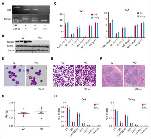 GSK3βabrogation in hematopoietic cells does not significantly alter hematopoietic cell maturation. (A) Example of polymerase chain reactionperformed on mouse DNA to confirm the genotype. (B) Protein levels of GSK3β, GSK3α, and β-actin as assessed by western blot from mouse total bone marrow cell lysate (n = 4 per genotype, in which WT is Cre− GSK3βf/f and KO is Cre+ GSK3βf/f). (C) GSK3β abrogation does not lead to any significant changes in white or red blood cell counts by CBC analysis ± standard error mean (SEM) (n = 8 per condition). (D) Morphologic analysis of mouse bone marrow aspirate does not reveal any differences between GSK3β WT and KO mice. Bone marrow aspirate was stained with Wright-Giemsa stain, and images were captured at original magnification ×50 (n = 4 per condition). (E) No differences in bone marrow morphology were observed between GSK3β WT and KO mice. Representative bone marrow sections were stained with hematoxylin and eosin (H&E), and images were captured at original magnification ×4 (n = 4 per condition). (F) No differences in spleen morphology were observed between GSK3β WT and KO mice. Representative spleen sections were stained with H&E, and images were captured at original magnification ×4 (n = 4 per condition). (G) No differences in spleen mass were observed between GSK3β WT and KO mice (n = 5 per condition). (H) No differences in the frequency of HPCs between GSK3β WT and KO mice were observed in peripheral blood samples. Average frequency of hematopoietic cell populations from mouse bone marrow as measured by flow cytometry (n = 4 per condition). CMP, common myeloid progenitor; f/f, floxed/floxed; f/w, floxed/wild-type; GMP, granulocyte-monocyte progenitors; Hb, hemoglobin; LK, c-kit low cells; LMPP, lymphoid-primed multipotent progenitors; LSK, Lineage− Sca-1+ c-Kit+cells; LT-HSC, long-term-HSC; Ly, Lymphocyte; MO, Monocyte; NE, Neutrophil; RBC, red blood cell; ST-HSC, short-term-HSC; WBC, white blood cell; w/w, wild-type/wild-type.