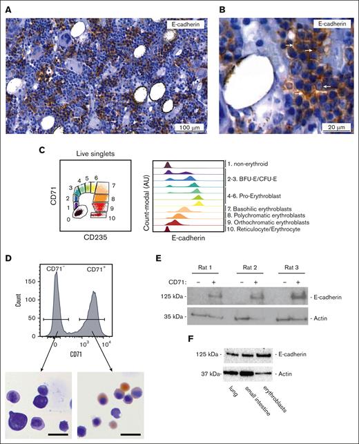 E-cadherin is expressed in the erythroid lineage in the rat BM. (A) Representative IHC staining for E-cadherin (brown) on healthy rat BM sections. (B) Zoom in of healthy rat BM. IHC staining indicates E-cadherin (brown) cell surface expression. (C) Flow cytometry plot, used to define erythroid differentiation stages (BFU-E; Burst-forming unit-erythroid, CFU-E; Colony-forming unit-erythroid) based on CD71 and CD235a surface expression in BM aspirate of a healthy individual, used to accordingly define E-cadherin cell surface expression. (D) Sorting strategy of rat CD71+ and CD71− rat BM cell population within living singlets. Representative benzidine stained cytospins of sorted CD71+ rat BM cells indicates that the majority of sorted cells represent basophilic erythroblasts (scale bar; 20µm). (E) Western blot of sorted CD71+ and CD71− rat BM cells showing E-cadherin is expressed in CD71+ but not CD71− cells (n = 3). (F) Western blot analysis showing E-cadherin protein expression in rat lung and small intestine material as well as sorted CD71+ rat erythroblasts.