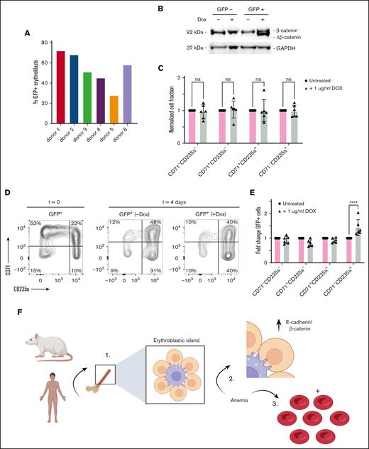 β-catenin promotes human EB differentiation. (A) Percentage of GFP+ EBs after Δ45β-catenin transduction in each of the 6 donors shown in Figure 6. (B) Western blot analysis of Δ45β-catenin expression in human EBs 24 hours after doxycycline (Dox) treatment. (C) Quantification of erythroid differentiation in response to Dox treatment compared with PBS-treated control cells, as determined by flow cytometry, revealing treatment with Dox (gray bars) not to alter the differentiation of EBs (n = 6; two-way ANOVA). (D) Representative flow cytometry plots of erythroid differentiation, using CD71 and CD235a cell surface staining, gated for GFP+ marked lentiviral transduced cells, in response to Dox-inducible Δ45β-catenin expression, as compared with untreated control conditions. (E) Quantification of flow cytometry data, representing fold change of GFP+ cells in CD71−CD235a−-, CD71+CD235a−-, CD71+CD235a+-, and CD71−CD235a+-defined cell stages of EB development, in untreated conditions (pink bars) or stimulated with Dox (gray bars) (n = 6; two-way ANOVA, ∗∗∗∗P < .0001). ns, not significant. (F) Graphical model displaying conserved expression of E-cadherin and β-catenin in human and rat erythroblatst, which upregulation in response to anemia may stimulate erythropoiesis.