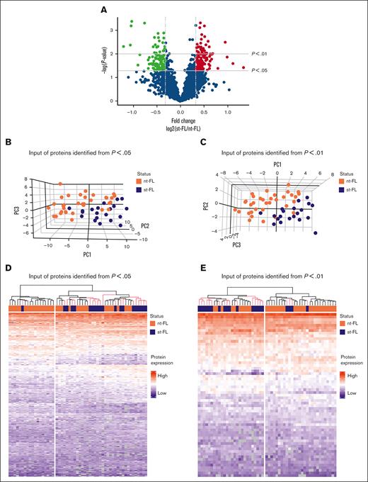 Differentially expressed proteins identified by MS-based proteomics differentiates, already at diagnosis, FL with and without subsequent transformation. (A) Proteins identified in diagnostic nt-FL and st-FL samples. The x-axis represents the fold changes as transformed by log2(st-FL/nt-FL); thus, red dots mark upregulated proteins at P < .05 and a fold change >20%, whereas green dots mark downregulated proteins at P < .05 and a fold change <20%. To allow for better visualization of highly significant data points, the negative logarithm (log10) of the P values are plotted on the y-axis. Horizontal lines mark P values of P < .05 and P < .01, respectively. Vertical dashed lines mark proteins with fold changes of at least 20%. (B) 3D PCA plot with input of differentially expressed proteins at P < .05 comparing nt-FL and st-FL samples. (C) 3D PCA plot with input of differentially expressed proteins at P < .01 comparing nt-FL and st-FL samples. (D) Hierarchal clustering analysis based on differentially expressed proteins at P < .05 comparing nt-FL and st-FL samples. (E) Hierarchal clustering analysis based on differentially expressed proteins at P < .01 between nt-FL and st-FL samples.
