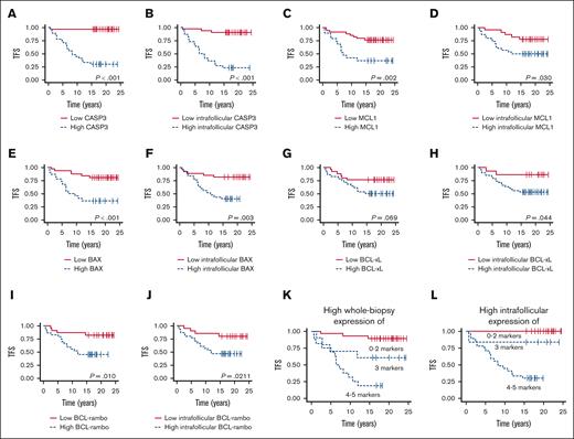 Outcome according to evaluated apoptotic biomarkers. (A-B) Association between whole biopsy and intrafollicular CASP3 expression and TFS (cutoffs, AF = 0.1423 and AF = 0.3627, respectively). (C-D) Association between whole biopsy and intrafollicular MCL1 expression and TFS (cutoffs, AF = 0.1133 and AF = 0.0264, respectively). (E-F) Association between whole biopsy and intrafollicular BAX expression and TFS (cutoffs, AF = 0.6221 and AF = 0.882, respectively). (G-H) Association between whole biopsy and intrafollicular BCL-xL expression and TFS (cutoffs, AF = 0.0007 and AF = 0.0007, respectively). (I-J) Association between whole biopsy and intrafollicular BCL-rambo expression and TFS (cutoffs, AF = 0.022 and AF = 0.0182, respectively). (K) Association between TFS and high whole tumor coexpression of 0 to 2, 3, and 4 to 5 of the analyzed markers. (L) Association between TFS and high intrafollicular coexpression of 0 to 2, 3, and 4 to 5 of the analyzed markers.