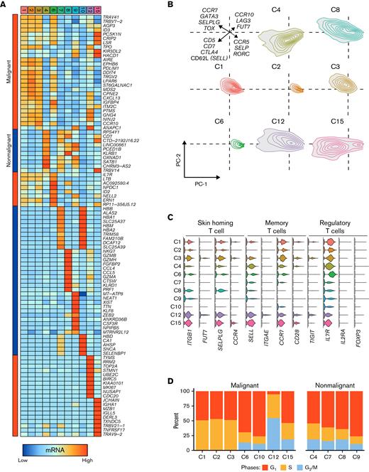 Heterogeneity in both normal and malignant SS T cells. (A) Heatmap of the top 10 genes for each of the single-cell clusters with Bonferroni P value < .05. Bars on the left indicate malignant (red) or nonmalignant (blue) predominance. (B) Density plots of the principal component analysis (PC1 and PC2) of genes involved in T-cell differentiation. (C) Selection of genes by cluster identity for skin-homing, central memory, and Treg phenotypes (IL7R-low/negative associated with Tregs). (D) Percent of cells in each cluster in phases of the cell cycle by regression analysis. (E) ssGSEA enrichment scores for gene signatures derived from the malignant SS clusters applied to a mixed MF/SS bulk RNA cohort.24 (F) The proportion of dominant V read vs ssGSEA enrichment scores for gene signatures derived from the malignant SS clusters applied to a mixed MF/SS bulk RNA cohort.24 (G) Z-score scaled ssGSEA enrichment scores for Biocarta, Kegg, and Hallmark libraries by single-cell cluster. The median values across nonmalignant (NM) clusters are reported in a single column.