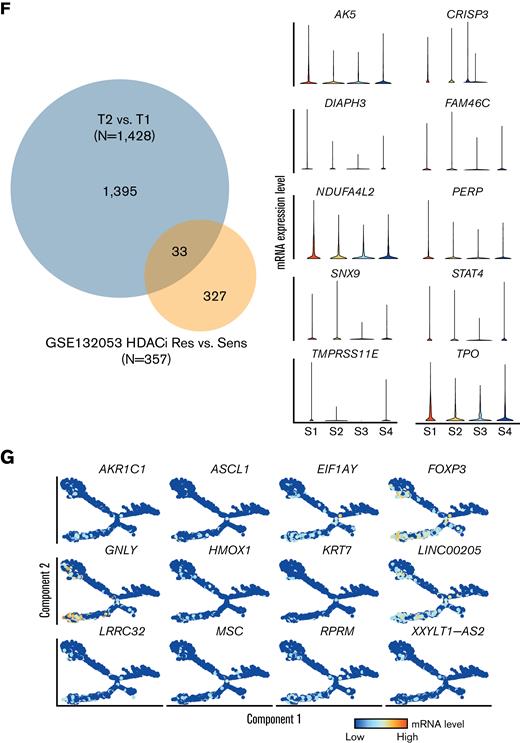 Single-cell analysis of before and after HDACi therapy shows diverging cell populations. (A) UMAP projection of malignant T cells at initial sample collection (T1, n = 2603) and after HDACi progression (T2, n = 2778) with percent of cells in clusters by time point. (B) Violin plots of cluster-specific gene markers compared with the entire cohort of malignant T cells across both time points. (C) Density plots of the principal component analysis of ssGSEA results by malignant T-cell clusters. (D) Trajectory manifold of malignant T cells using the monocle R package with both the Seurat clusters and time point displayed. (E) Median mRNA expression of the top 20 significantly (adjusted P value < .05) upregulated markers by transition state. (F) Venn diagram of the overlap in significant genes between the transcriptional states in the cell trajectory and comparing HDACi-resistant vs -sensitive patients with SS in GSE13205310 with a selection of the 33 overlapping genes displayed as violin plots. Significant genes were defined as log-fold change ≥ 0.5 and adjusted P value < .05. (G) Gene expression patterns of significantly expressed genes by transition state that are previously reported upregulated in an HDACi-resistant SS10 along the cell trajectory manifold.