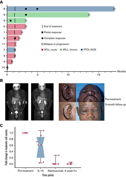 Signs of clinical efficacy after treatment with IL-15 and alemtuzumab. (A) Swimmers’ plot of all trial participants during on-study follow-up. (B) FDG-PET and clinical photograph of a patient with chronic subtype ATL before and 3 months after treatment. (C) Leukemic cell count during and after treatment with IL-15 and alemtuzumab represented as fold-change from baseline in absolute number of ATL cells detected by flow cytometry. Images published with study participant’s consent.