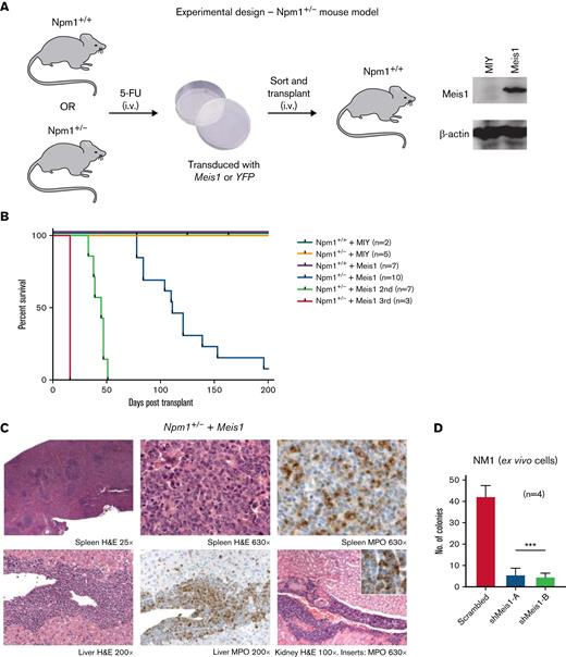 Npm1 haploinsufficiency and Meis1 overexpression collaborate to induce AML. (A) Schematic of the experimental design of in vivo experiments with Npm1. (B) Kaplan-Meier plot of NPM1+/+ mice transduced with a MIY empty vector (n = 2), NPM1+/− plus MIY (n = 5), NPM1+/+ plus Meis1 (n = 7), NPM1+/− plus Meis1 (n = 10), secondary transplants of NPM1+/− plus Meis1 leukemic BM (n = 7), and tertiary transplants of NPM1+/− plus Meis1 leukemic BM (n = 3). (C) Histopathological analysis of a NPM1+/− plus Meis1 mouse. (D) Colony-forming assay of NPM1+/− plus Meis1 ex vivo cells (NM1) transduced with scrambled control or shRNA against Meis1 (n = 4). indicates number of independent experiments. ∗P < .05; ∗∗P < .001; ∗∗∗P < .0001. MIY, MSCV IRES YFP plasmid; n, number of independent experiments.