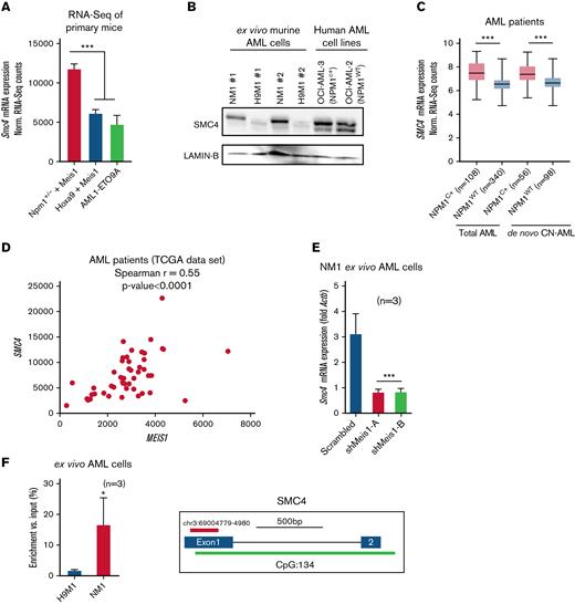 The cell cycle protein SMC4 is a downstream target of MEIS1 in NPM1c AML. (A) Smc4 mRNA expression in NPM1+/− plus Meis1, Hoxa9 plus Meis1, and AML1-ETO9A leukemic mice; values are shown as normalized RNA-seq counts. (B) Western blot analysis on protein extracts from NM1, H9M1 murine ex vivo leukemic cells, and human AML cell lines OCI-AML3 and OCI-AML2 probed with antibody against SMC4 and LAMIN-B as endogenous control. (C) SMC4 mRNA expression in NPM1c vs NPM1WT AML patients in total human AML and de novo CN-AML patient cohorts from the Vizome data set; values are shown as normalized RNA-seq counts.26 (D) Spearman correlation of SMC4 and MEIS1 expression in NPM1c AML patients (r = 0.55, P < .0001). (E) Smc4 mRNA expression in NM1 cells transduced with scrambled control or shRNA against Meis1 (n = 3); values are shown as fold change to housekeeping gene control, Actb. (F) CUT&RUN of MEIS1 in H9M1 and NM1 cells analyzed for enrichment of Smc4 promoter (n = 3); values are shown as percentage Smc4 enrichment in input control. ∗P < .05; ∗∗P < .001; ∗∗∗P < .0001. mRNA, messenger RNA. Actb, Actin Beta; n, number of experimental replicates.