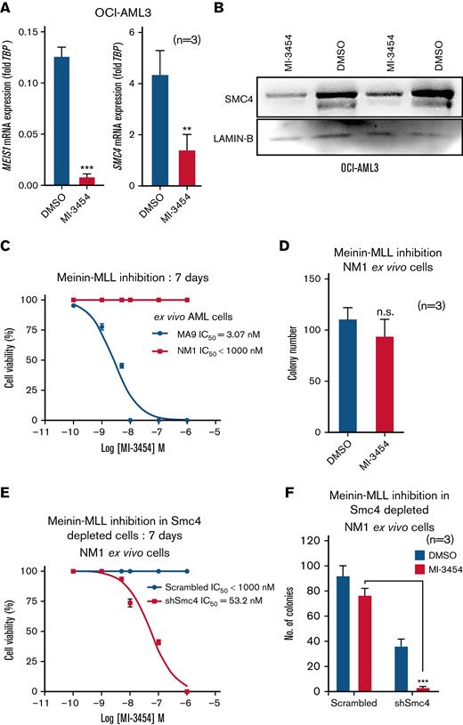 MEIS1 and SMC4 expression levels affect response to MI-3454 treatment. (A) MEIS1 and SMC4 mRNA expression in OCI-AML3, treated with DMSO control or MI-3454 (25 nM, n = 3) for 7 days; values are shown as fold change to housekeeping gene control, TBP. (B) Western blot analysis showing 2 experimental replicates of SMC4 protein expression in OCI-AML3 cells treated with 25 nM MI-3454 for 7 days vs DMSO control. LAMIN-B was used as endogenous control. (C) IC50 calculation of MI-3454 inhibitor on Meis1 overexpressing NM1 cells vs endogenous Meis1 expressing ex vivo MLL-AF9 cells. (D) Colony number in the colony forming assay of NM1 cells treated with DMSO and MI-3454. (E) IC50 calculation of MI-3454 inhibitor on NM1 cells transduced with scrambled control or shRNA against Smc4. (F) Colony forming assay of NM1 cells transduced with scrambled control and shRNA-mediated Smc4 knockdown, treated with DMSO and MI-3454 (n = 3). ∗P < .05; ∗∗P < .001; ∗∗∗P < .0001. DMSO, dimethyl sulfoxide; n, number of independent experiments; TBP, TATA-binding protein.