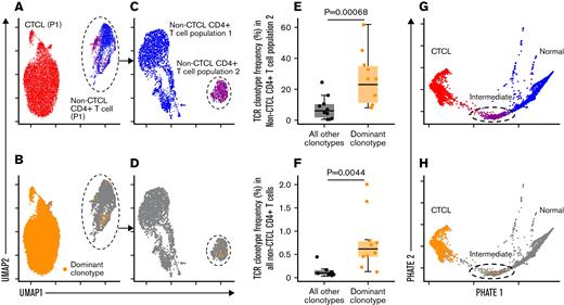 PHATE analysis reveals circulating putative precancerous intermediate CD4+T-cell populations in CTCL. (A) Representative UMAP plot of CD4+ T cells from a patient with CTCL resulted in 2 major separate annotated clusters: CTCL cells (red) and non-CTCL CD4+ T cells (blue+purple). (C) The non-CTCL CD4+ T cells were further divided into 2 clusters: population 1 (blue), and population 2 (purple). (B,D) The dominant TCR clonotype is highlighted in yellow over the same UMAP. A group of cells containing the dominant clonotype fell within the non-CTCL CD4+ T-cell population upon unsupervised clustering. A comparison of the mean frequency of the dominant (malignant) TCR clonotype vs all other TCR clonotypes in the non-CTCL CD4+ T-cell population 2 (E) and in the total non-CTCL CD4+ T-cell population (F) revealed that the dominant clonotype frequency was overrepresented in both populations (n = 10, paired t test). (G) PHATE mapping revealed the non-CTCL CD4+ T-cell population 2 to be an intermediate group of cells (purple) falling between normal CD4+ T cells (blue) and CTCL cells (red). (H) This intermediate group contained cells with the dominant clonotype, highlighted in yellow throughout the PHATE map. UMAP, Uniform Manifold Approximation and Projection.