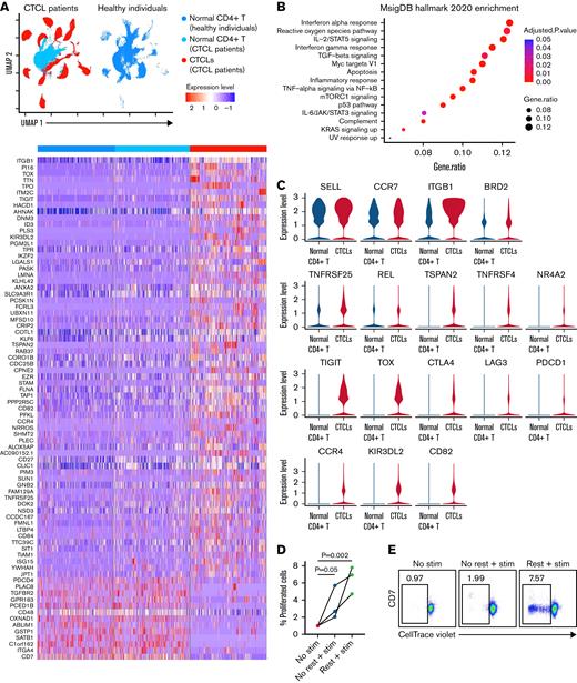 Transcriptional characteristics of common features among heterogeneous patients with CTCL. (A) Side-by-side view of the integrated UMAP of CD4+ T cells from 11 patients with CTCL and 3 healthy controls, along with a heat map displaying the DEGs when all CTCLs cells were compared with all normal CD4+ T cells combined from patients and healthy controls (heat map: minimum percentage >0.25%, minimum difference in percentages >0.2; adjusted P ≤ .05, log fold change threshold = 0.25). (B) Pathway analysis of all DEGs revealed 15 enriched (adjusted P ≤ .05) pathways in the CTCLs. (C) Plots demonstrate increased expression of the central memory T-cell activation genes SELL, CCR7, ITGB1, BRD2, TNFRSF25, REL, TSPAN2, TNFRSF4, and NR4A2 and the T-cell exhaustion genes TIGIT, TOX, CTLA4, LAG3, and PDCD1 in CTCLs vs normal CD4+ T cells, as well as increased CD82, CCR4, and KIR3DL2 gene expression in CTCLs. (D) The percentage of CTCLs that proliferate in response to TCR engagement was significantly increased after a period of rest in vitro. Each line represents 1 patient-derived sample (n = 3). (E) Representative flow cytometric analysis of the proliferative capacity of CTCL cells. Cells were cultured with no stimulation for 4 days (No Stim) or were stimulated immediately after isolation (No Rest + Stim) or after a 4-day rest (Rest+Stim). Simulation consisted of anti-CD3+anti-CD28 for 2 days followed by washing and a 2-day expansion in the absence of stimuli. UMAP, Uniform Manifold Approximation and Projection.