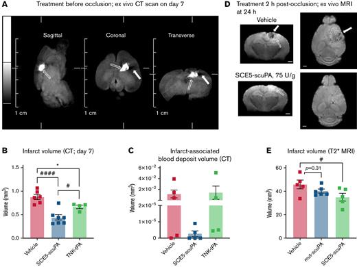 SCE5-scuPA treatment, either before or 2 hours post-photothrombotic stroke, reduces infarct volume and associated cerebral blood deposits. (A) Representative CT images of a mouse brain at 7 days post-photothrombotic stroke (without treatment). Solid arrows indicate hypointense (darker) voxels, consistent with low-density matter characteristic of infarcted cerebral tissue. Open arrows indicate hyperintense (brighter) voxels, representing higher density matter characteristic of blood deposits within the infarct. Scale bars as indicated on the image. (B and C) CT imaging–based quantification of infarct size (B) and blood volumes within the infarct (C) at 7 days poststroke in mice treated before photothrombotic stroke with saline (vehicle), SCE5-scuPA (150 U/g), or TNK-tPA (2.5 mg/kg). (D and E) Representative mean T2∗-weighted coronal and axial MRI acquisitions at 24 hours after stroke (postmortem, intra-skull) (D) and the corresponding, MRI-based quantification of infarct size (E) in mice treated 2 hours post-photothrombotic stroke with saline (D; top panels) or SCE5-scuPA (75 U/g; D; bottom panels). Efficient clearance of blood deposits (dark areas in the vehicle-treated brain; solid arrows in panel D) and reduction in the edematous (bright; open arrows in panel D) area can be observed. Scale bars = 1 mm. Data are presented as mean ± standard error of the mean. #P < .05, ####P < .0001 by one-way analysis of variance with Tukey’s or Dunnett’s post hoc analysis. ∗P < .05 by a t test (unpaired, 2-tailed). n = 4 to 11.