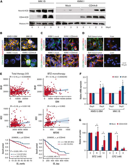 MM cell clusters acquire PI resistance via activation of CD44 signaling. (A) We cultured MM.1S, KMM.1-mock and KMM.1-CD44v9 cells in the presence of 500 ng/mL of HA under shear stress for the indicated periods and isolated nuclear extracts for immunoblot analysis for the expression of Notch2-ICD, CD44-ICD and histone H1 (internal control). (B) Cytospin specimens were prepared during the experiments described in A for immunocytochemical staining with anti-CD44 and anti-Notch2 antibodies, followed by the staining with Alexa Fluor 488-conjugated anti-mouse IgG (green) and Alexa Fluor 594-conjugated anti-rabbit IgG (red). (C) Tumor sections were obtained from mice described in Figure 5D and stained with FITC-conjugated anti-CD138 (green) and anti-CD44 or anti-Notch2, followed by the staining with Alexa Fluor 594-conjugated anti-rabbit IgG (red). (D) Histological sections were prepared from soft tissue tumors and livers of MOPC-transplanted BALB/c mice (Figure 2F) and stained with FITC-conjugated anti-mouse CD138 (green) and anti-mouse CD44 or anti-mouse Notch2, followed by the staining with Alexa Fluor 594-conjugated anti-rabbit IgG (red). Nuclei were counterstained with DAPI (blue). Bar represents 15 μm. (E) We examined the correlation between the expression of CD44 and its effectors and the prognostic impact of CD44 using DNA microarray data from patients with MM treated with Total Therapy 2/3 (GEO accession number GSE4581) or bortezomib monotherapy54 (BTZ monotherapy) with the GenomicScape tool (www.genomicscape.com). Upper and middle panels: Correlation between CD44 and NFkB1 or between Notch2 and HES1. Lower panels: Kaplan-Meier curves of patients with MM with high (red) and low (blue) CD44 expression. P values and the hazard ratio (HR) were determined by the log-rank test. (F) KMS12-BM and MM.1S cells were cultured with HA under shear stress for the indicated periods and subjected to quantitative reverse transcription-PCR for downstream CD44 effectors. Data were quantified by the 2–ΔΔCt method using GAPDH as a reference gene and are shown as the fold increase against the values for Day 0. (G) Mock- or CD44-ICD-transfected KMM.1 cells were cultured with the indicated concentrations of bortezomib or carfilzomib. Cell proliferation was assessed after 72 hours and is expressed as a percentage of the value for corresponding untreated cells. ∗P < .05 determined by one-way ANOVA with the Student-Newman-Keuls multiple comparison test (n = 6-10).
