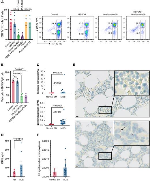 A subset of patients with MDS express high levels of RSPO3. (A) Representative FACS plots and corresponding bar graph quantifying the proportion of CD71–Ter119+ RBCs after in vitro culturing in the absence or presence of indicated growth factors; n = 3 to 9 per condition. (B) Bar graph quantifying the proportion of viable CD45RA+IgM– B-progenitors from control animals after culturing for 48 hours in the absence or presence of indicated growth factors; n = 4 per condition. (C) Expression of RSPO2 and RSPO3 in bone marrow (BM) of n = 13 control donors and n = 29 patients with MDS. Gene expression was obtained in the form of normalized reads per kilobase gene model per million total reads (nRPKM). (D) Circulating RSPO3 levels in plasma from control donors and patients with MDS; n = 9 per group. (E) Representative images of ISH for RSPO3 transcript distribution in BM core biopsy samples from n = 2 control donors and n = 12 patients with MDS. Rectangles mark regions shown at higher magnification; arrow points at a hematopoietic cell with an RSPO3 transcript. (F) Bar graph quantifying the expression of RSPO3 in normal BM and MDS BM. ISH-positive signal is normalized to hematoxylin areas. Data are represented as mean ± standard error of the mean. One-way analysis of variance followed by Dunnett’s test for multiple comparison (panels A and B), Mann-Whitney test for (panels C and D). Scale bar, 10 μm. FITC, fluorescein isothiocyanate; ND, normal donor; n.s., not significant (P > .05); PE, phycoerythrin.