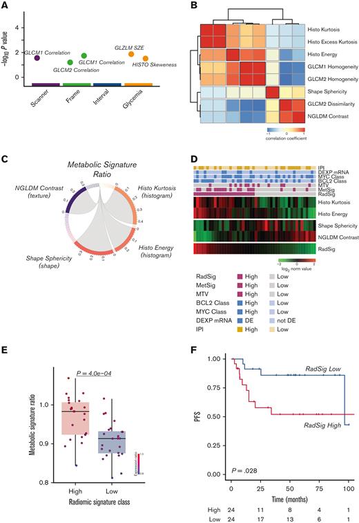 Integration of the T-GEP–based MetSig with FDG-PET radiomics defines a RadSig significantly associated with outcome in DLBCL. (A) Graph illustrating radiomic features considered not robust and excluded because of significantly different values according to scanner model, frame duration, time between injection and acquisition, and glucose level. The x-axis shows the parameters and the corresponding P values in negative log10 scale are illustrated on the y-axis. Each circle on the plot represents a single radiomic feature. (B) Correlation matrix heatmap of radiomic features displaying the Spearman correlation coefficient between each pair of radiomic features; radiomic features were reordered by unsupervised hierarchical clustering for visualizing highly intracorrelated features. Five clusters of radiomic features were generated (the red blocks along the diagonal indicate high intracluster correlation, blue squares indicate negative correlation, and red squares indicate positive correlation). (C) A circos plot showing correlation between the MetSig and radiomic features. Only radiomic features with a significant correlation (P < .05) with the MetSig are shown in the circos plot. (D) Heatmap representing the 4 informative radiomic features composing the RadSig shown as rows, and patients with DLBCL samples shown as columns in the discovery cohort. (E) Box plot graph depicting MetSig ratio values in the RadSig-low and -high patient subgroups. P value was calculated with the Mann-Whitney Wilcoxon test. (F) PFS of the discovery cohort according to the RadSig status in RadSig-low vs RadSig-high patient subsets. P value was calculated with the log-rank test. GLCM, gray level coorcuurence matrix; NGLDM, neighboring gray level dependence matrix.