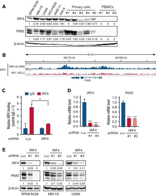 PIM2 expression is transcriptionally regulated by IRF4 in MM cells. (A) Whole cell lysates, which were extracted from the MM cell lines, RPMI 8226, MM.1S, U266, NCI-H929, KMS-11, and INA-6, primary CD138-positive cells derived from patients with MM, and PBMCs from healthy donors were subjected to immunoblotting. β-Actin served as a loading control. (B) Publicly available ChIP-seq data (GSM1195560) were analyzed for the distribution of IRF4 binding at the PIM2 locus in MM.1S cells. The x-axis shows the genomic position. KK1, which is an adult T-cell leukemia/lymphoma cell line, was used as a negative control (GSM2481669). (C) RPMI 8226 cells were transduced with shLuc or shIRF4 (#1). Transduced cells were subjected to a ChIP-Q-PCR analysis for IRF4 occupancy on the PIM2 gene. Results were normalized to control IgG. Error bars show the SD of triplicates. ∗∗P < .01 significantly different from the shLuc condition; the Student t test. (D) Total RNA was extracted from RPMI 8226 cells transduced with shLuc or shIRF4 (#1, #2) and then subjected to Q-PCR. GAPDH served as an internal control. Values represent the amount of mRNA relative to the shLuc control. Error bars show the SD of triplicates. ∗∗∗P < .001 significantly different from the control; the Tukey-Kramer multiple comparison test. (E) RPMI 8226, MM.1S, and U266 cells were transduced with shLuc or shIRF4 (#1, #2). The whole cell lysates extracted were subjected to immunoblotting using the indicated antibodies. β-Actin served as a loading control. Relative expression levels of each target, which are normalized to its loading control, are shown below for each immunoblotting image. PBMCs, peripheral blood mononuclear cells.