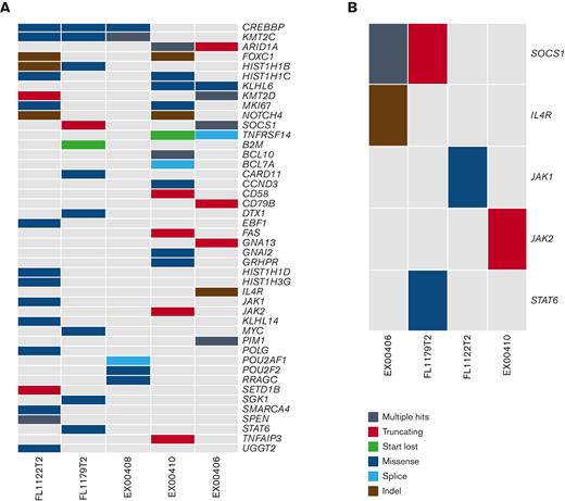 WES analysis of 5 tFL-PMBLsig-pos cases. (A) Alterations found in a curated list of PMBL and FL/DLBCL-related genes across all 5 tFL-PMBLsig-pos cases. (B) Alterations in the JAK-STAT pathway found among 4 of 5 tFL-PMBLsig-pos cases.