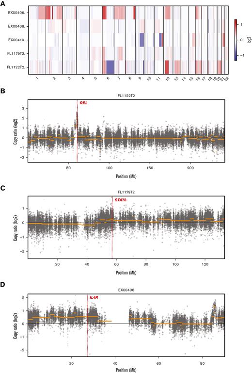 CN analysis of 5 tFL-PMBLsig-pos cases. (A) Heatmap showing CN changes by chromosomal location for each tFL-PMBLsig-pos case. (B-D) Graphs showing more detailed CN changes by location in chromosomes 2 (B), 12 (C), and 16 (D). Genes of note are labeled and highlighted with a dotted red line and include REL on chromosome 2 (gains in 3 of 5 cases; case 5/FL1122T2 illustrated), STAT6 on chromosome 12 (gains/amplification in 3 of 5 cases; case 4/FL1179T2 illustrated), and IL4R on chromosome 16 (gains in 2 of 5 cases; case 1/EX00406 illustrated).