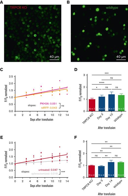 Transfusion of TRPC6-KO RBCs into WT mice. (A) Microscopic fluorescence image of RBCs from a TRPC6-KO mouse loaded with the Ca2+ dye Fluo-4 (5 μM, 1 hour, 37°C) and immobilized with Cell-Tak). Microscopic imaging12 was performed while the cells were stimulated with LPA (5 μM, 5 minutes). (B) Microscopic fluorescence image from the same experiment described in panel A but with RBCs from a WT mouse (C57Bl6/N). The full image sequences, where the images in panels A and B were taken from are provided in the supplemental Material. Scale bar, 40 μM (A-B). (C) Two hundred microliters of RBCs from total TRPC6-KO mice (hematocrit of 50% in a 0.9% NaCl solution) were transfused into WT mice (C57Bl6/N) by retrobulbar injection under isoflurane narcosis. First, TRPC6-KO RBCs were labeled with the dye PKH26 (Sigma-Aldrich)4 (dark red symbols). Alternatively, the TRPC6-KO mouse was crossbred with a mouse expressing tdRFP,19 that is, having RBCs with an intracellular fluorescent protein (light red symbols). Before transfusion and up to 14 days after transfusion, blood was sampled at the facial vein (10 μL) from the transfused mice. The relative number of PKH26/tdRFP-positive cells is provided in supplemental Figure 3A. RBCs were video imaged as shown in panels A and B for 15 minutes. The maximum value of the background-corrected, cellular F/Fo signal of PKH26- or tdRFP-positive cells was analyzed.4 Each plotted data point is the median of at least 100 RBCs from 1 mouse (natural decrease in cell number over time after transfusion). (D) Replot of the data presented in panel C at selected time points and comparison to WT RBCs from the transfused mice. (E) Same experiments as in panel C with all data fitted together (red symbols) and similar experiments as in panel C but with WT mice splenectomized 1 week before transfusion (gray symbols). For splenectomy, mice were anesthetized by an injection of ketamine (75 mg/kg body weight) and xylazine (15 mg/kg body weight). After abdominal sectioning, the splenic vein and splenic arterywere ligated, and the spleen was removed. The relative number of tdRFP-positive cells under the different experimental conditions is provided in supplemental Figure 3B. (F) Replot of the data presented in panel E at selected time points and comparison to WT RBCs from the transfused mice. In panels D and F, values are plotted as the mean ± standard deviation. N, number of animals. In comparison, “ns” denotes not significant (P ≥ .5), ∗P < .05, ∗∗P < .01, ∗∗∗P < .001, and ∗∗∗∗P < .0001. Significance was tested with ordinary 1-way analysis of variance with Tukey multiple comparison tests (Prism 9, GraphPad Software, San Diego, CA).