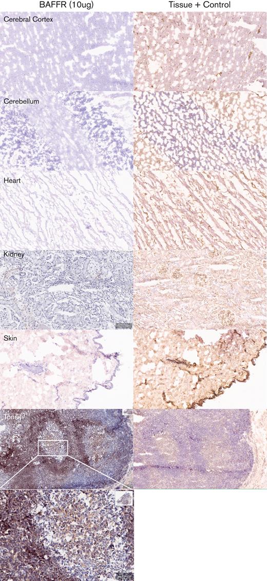 Tissue specificity of BAFF-R H90-5 by immunohistochemistry. Frozen tissue sections were stained at a concentration of 10 μg/mL with BAFF-R H90 (top row) using various normal human tissue sections from 3 separate donors. Anti–beta-2-microglobulin (bottom row) was used as an internal tissue control. Lymphoid tissues such as the tonsil (positive control) showed distinct, strong staining within the mantle cuffs of the follicles. No nonlymphoid frozen tissues showed cross-reactivity with BAFF-R H90-5. Representative tissue sections are shown (original magnification ×40; except for tonsil shown at original magnifications ×40 and ×200).
