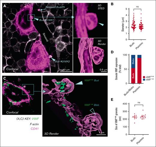 MK budding is prominent in the bone marrow of mice. C57BL/6 mouse femoral bone marrow cryosections (10 and 40 μm) were immunostained with anti-CD41 (pink, for platelets and MKs) and anti-VWF (green, for granule content), co-stained with phalloidin (white, for F-actin), and then subjected to confocal and STED microscopy (Leica SP8; 93× glycerol objective; NA 1.3; z-step size, 80 nm). The images were deconvoluted using Huygens Software (ver. 20.04), processing was done using ImageJ (Ver. 1.53c), and surface renders were created using Imaris (ver. 9.8) using deconvolved fluorescent images. (A) Representative 2D confocal image (left panel) showing 2 MKs (MK1 and MK2) budding into a sinusoid. Their respective buds (Bud #1 and Bud #2), being released into the sinusoid (white) are indicated by arrow heads (▶). Buds were differentiated from transiting platelets by clear evidence of attachment to MKs based on the presence of CD41 joining the bud to the MK body. A released intrasinusoidal platelet is indicated by an arrow, which is not in direct proximity to a MK, differentiating it from a bud. Right panels depict a CD41+ STED optical section (top) and a 3D render created from the z-stack of the entire bud (bottom) of Bud #1 from MK1 (images were taken from one representative C57BL/6 bone marrow of n = 3, scale bar indicated). (B) Dot plot showing the size of buds and platelets in sinusoids, expressed as their maximal transverse diameter, from the evaluation of individual optical sections (50-60 buds and platelets from n = 3, C57BL/6 bone marrow), acquired using STED microscopy. (C) Representative confocal (left panel) and 3D STED render (right panel) images showing VWF+ buds (green; with granules) and VWF– blebs (without α-granules) on MKs. (D) Graph showing the percentage of VWF+ buds and VWF– blebs on MKs (64 budding MKs analyzed from n = 3, C57BL/6 bone marrows). (E) Graph showing the size of VWF+ granules within buds and platelets in the sinusoids. Data represent the mean granule size in 11 buds and 9 platelets. Statistical analysis (B, E) was performed using an unpaired t-test (GraphPad prism, v9.1.2).