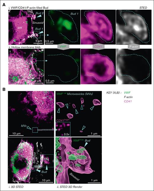 MK buds are distinguishable from blebs and MVs. C57BL/6 mouse femoral cryosections were stained with antibodies against CD41 (pink), VWF (green), or phalloidin (white), and imaged using STED microscopy. (A) Representative 2D STED images showing MK buds with internal VWF, CD41, and F-actin (i), in contrast to hollow MK blebs (ii). (i, ii) Left hand panels depict merged, low magnification images, whereas the remaining panels depict a magnified bud (i) and hollow bleb; (ii) with individual fluorescence channels for VWF, CD41, and F-actin at high magnification. (B) Representative 3D STED (left panels) and 3D render (right panels) images showing VWF– MK MVs (top panel) and VWF+ MK buds (lower panel). Note: The top left panel contains an inset with highlighted MVs magnified by 3.5×, and the CD41 intensity increased to illustrate MVs.