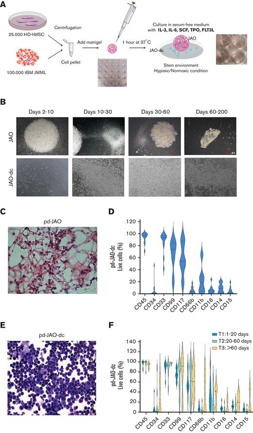 Characterization of JMML progenitors generated in pd-JAO system. (A) Schematic representation of the pd-JAO 3D system generation. (B) Time course of pd-JAO 3D structure (upper panel) and pd-JAO derived cells (lower panel) in in vitro culture. Stereomicroscopic images at original magnification 2× and 6.3×. (C) Hematoxylin/eosin staining of fixed pd-JAO 3D structure. Notably, JMML cells are incorporated in the ECM. Original magnification 40×. (D) Violin plot of immunophenotype analysis of pd-JAO-dc at 15 days of the 3D system generation in 13 of 15 patients tested. (E) May-Grünwald-Giemsa (MGG) staining (20× magnification) of pd-JAO-dc after 15 days of culture. (F) Immunophenotype analysis of pd-JAO-dc collected at 3 different time points from the 3D generation (ie, T1: 1-20 days; T2: 20-60 days; T3: >60 days) For each marker, we reported the percentage of positive live cells. HD-hMSC, healthy donor human mesenchymal stromal cells; tBM, total BM bulk.
