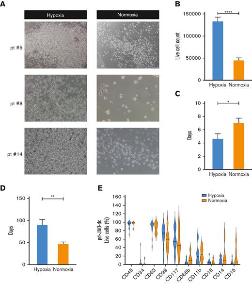 Enhanced proliferation of JMML progenitor cells under hypoxic condition. (A) Representative microscopic images (6.3× magnification) of pd-JAO-dc maintained under hypoxic and normoxic conditions on day 15 derived from 3 patients diagnosed with JMML. (B) pd-JAO-dc cell count (day 15, normoxia N = 14, hypoxia N = 33), (C) time of cell sprouting from the 3D system (normoxia N = 11, hypoxia N = 13), and (D) pd-JAO system death (normoxia N = 11, hypoxia N = 12) in hypoxia and normoxia. ∗P ≤ .05; ∗∗P ≤ .01;∗∗∗∗P ≤ .0001 by unpaired t test with Welch's correction. Bars are shown as mean ± standard error of the mean (SEM). (E) Immunophenotype analysis of pd-JAO-dc maintained in the 2 tested conditions. Pt, patient.