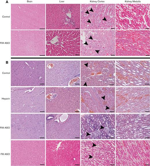 Histological analysis of organs. Shown are representative H&E-stained sections of organ tissue harvested from rabbits in the heparin/protamine cohort (A) and the citrate/calcium cohort (B). No significant necrosis, hemorrhage, or parenchymal damage was identified in any of the brain or liver tissues in either cohort, regardless of treatment. There was uniform evidence of renal and liver venous congestion in the control and heparin-treated animals, regardless of treatment. Glomeruli (arrowheads) were generally intact without evidence of necrosis. Scale bars, 100 μm; original magnification ×100.