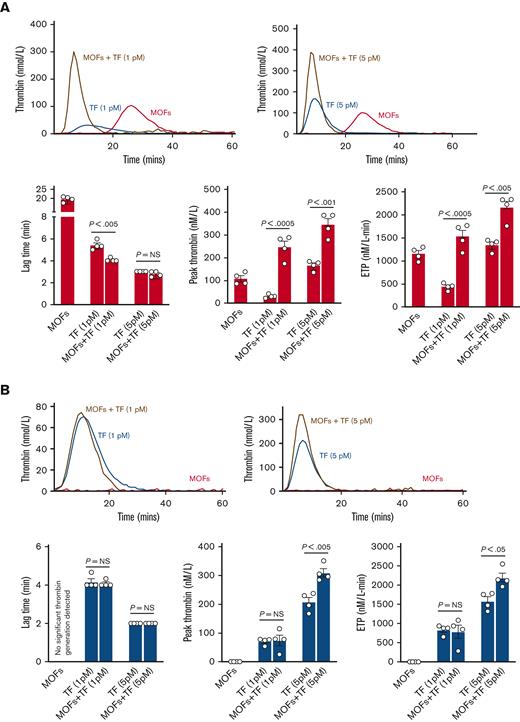 MOF-driven thrombin generation is dependent on factors XII and XI. (A) Shown are representative TGA curves and quantitation of the lag time, peak thrombin, and endogenous thrombin potential when MOFs are added to normal human plasma alone or in combination with TF. Note that MOFs alone are capable of significant thrombin generation in the absence of TF. MOFs also augment TF-mediated thrombin generation when used in combination with either a low (1 pM) or high (5 pM) concentration of TF. (B) Shown are the results of TGA assays where MOFs were added to FXII-depleted human plasma (FXIIO) with or without TF. Note that depletion of FXII completely abrogated thrombin generation driven by MOFs alone. FXII elimination also abrogated the increase in thrombin generation seen when MOFs were added to a low concentration of TF. However, MOFs still significantly increased thrombin generation when added together with a higher concentration of TF. (C) Shown are the results of TGA assays where MOFs were added to FXI-depleted human plasma (FXIO) with or without TF. FXI depletion also eliminated thrombin generation triggered by MOFs alone. Moreover, FXI depletion also completely mitigated the increase in thrombin generation seen when MOFs were added together with either low or high concentrations of TF. P values were generated using a Student t test; data represent the mean and SEM.