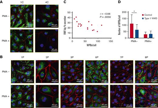 Confocal immunofluorescence microscopy of ECFCs after basal and stimulated VWF release. ECFCs derived from healthy controls (A) and patients with type 1 VWD (B). Images in the top row were taken during basal VWF release (PMA-) and images in the bottom row were taken after stimulated VWF release (PMA+). ECFC identification labels are displayed across the top of the figure. ECFCs were stained for VWF (green), VE-cadherin (red) and DAPI (blue). Images are shown at 63× magnification with white scale lines representing 40 μm. Images were taken using a Lecia TCS SP8 Confocal Microscope. (C) Pearson r correlation between VWF section measured by ELISA and WPB count quantified from confocal microscopy images of control and type 1 VWD ECFCs during basal and stimulated release. (D) The number of WPBs contained in control and type 1 VWD ECFCs after basal and stimulated secretion. ∗P<.05.
