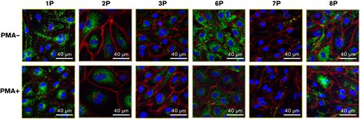 Transcriptome analysis of basal VWF release. (A) Volcano plot outlining DEGs between type 1 VWD and control ECFCs during basal release. The horizontal dashed line represents an adjusted P value of 0.1 and the vertical dashed lines represent 1.5-fold change relative to control ECFCs. DEGs meeting the 0.1 corrected P value threshold and that exhibit a fold expression >1.5 are in red. Relative expression of VWF (B) and V2R (C). (D) Interacting miRNAs and mRNAs that were differentially regulated during basal VWF release are displayed in a chord diagram. Green indicates upregulation and red indicates downregulation relative to control ECFC expression. The outer ring indicates direction of transcript regulation, and the ribbon color represents specifically the direction of miRNA regulation.