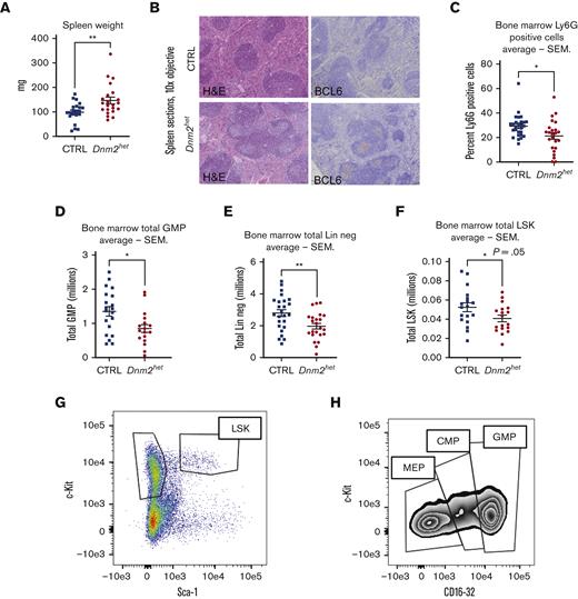 Spleen histology, BM neutrophil content and hematopoietic progenitors in female Dnm2het mice. (A) Comparison of spleen weights in female Dnm2het and CTRL mice. Overall, when comparing groups involving all ages (N = 18 and above), female Dnm2het mice developed splenomegaly. (B) Spleen histology in 12- to 25-week-old female Dnm2het and CTRL mice, showing florid reactive germinal center hyperplasia with the expansion of BCL-6 positive lymphocytes within secondary reactive follicles. CTRL mice: sections demonstrate a normal proportion and white and red pulp distribution. BCL-6 immunostain shows the absence of secondary reactive follicles. Dnm2het mice: the white pulp was mildly expanded by reactive, secondary follicles. BCL-6 highlights germinal center lymphocytes. Objective: 10×. (C) Average percentage of Ly6G positive BM cells in female Dnm2het and CTRL mice when comparing groups involving all ages (N = 24 and above). Scoring by immunohistochemistry demonstrated decreased BM Ly6G positive neutrophil. Histology slide images were captured using the Aperio AT2 slide scanner at 20X or the CRI Nuance Spectral Imaging microscope, unless specified otherwise. Quantification was performed by Halo Image analysis. (D) Average total GMP (lineage negative, R-IL7 negative, c-Kit positive, Sca-1 negative, CD34 positive, CD16/32 high) in the BM of female Dnm2het and CTRL mice when comparing groups involving all ages (N = 17 and above). (E) Average total BM lineage negative (Lin neg) cells in the BM of female Dnm2het and CTRL mice (N = 23 and above). (F) Average total BM lineage negative, R-IL7 negative, Sca-1 positive, c-Kit positive (LSK) cells in the BM of female Dnm2het and CTRL mice when comparing groups involving all ages (N = 18 and above). Dnm2het female mice displayed a decrease in BM Lin neg cells counted after immunomagnetic lineage depletion, decreased LSK and GMP measured by flow cytometry when comparing groups involving all ages. (G) Representative plot of LSK BM cells flow cytometry analysis. (H) Representative plot of megakaryocyte-erythrocyte progenitor (MEP), common myeloid progenitor (CMP), and GMP flow cytometry analysis. Data are shown as mean +/− SEM. ∗P < .05, ∗∗P < .01, t-test.