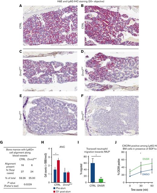 Granulocyte BM distribution, migratory response and CXCR4 expression in Dnm2-defective mouse granulocytes. (A-F) Immunohistochemical staining for mature granulocytes with Ly6G in the BM of representative CTRL (panels A-B) and Dnm2het female mice (panels C-F). Fewer Ly6G positive cells (granulocytes) were present in the BM of Dnm2het mice when comparing groups involving all ages (N = 30 and above). Histology slide images were captured using the Aperio AT2 slide scanner at 20X or the CRI Nuance Spectral Imaging microscope, unless specified otherwise. (G) A linear pattern of distribution of Ly6G positive cells (granulocytes) was observed in fewer mice among the Dnm2het group than in the CTRL group, indicating that the migration pattern within the BM is altered in the Dnm2het group (N = 30 and above). (Panel F) The BM from 1 Dnm2het mouse was completely effaced by immature myeloid precursors. (H) ANC in the peripheral blood 1 day after intraperitoneal alum injection in old female Dnm2het and CTRL mice. Older Dnm2het female mice (>52 weeks, N = 3) failed to show a rise of ANC, indicating a loss of rapid egress of neutrophils from the BM reserve. (I) Transwell migration assay of BM neutrophils from wild-type young female adults (aged 12-24 weeks, N = 3) treated with the DNM inhibitor DNSR, compared with CTRL neutrophils. Wild-type mouse neutrophils separated from the BM and treated with DNM-GTPase inhibitor, DNSR have reduced migration toward n-formylmethionyl-leucyl-phenylalanine, a chemoattractant for neutrophils, indicating that DNM function is necessary for this chemotactic response. (J) CXCR4 surface expression analyzed by flow cytometry in DNSR-treated and in CTRL BM Ly6G-high granulocytes from wild-type young female adults (aged 12-24 weeks, N = 4), when exposed for varying time periods to chemoattractant SDF1a (100 ng/mL). After 30 minutes of SDF1a exposure, surface CXCR4 was expressed to a greater extent among DNSR-treated neutrophils than in CTRL neutrophils. (Panels H-J) Each graph summarizes at minimum 3 to 4 independent experiments. Error bars indicate SEM. Only marked, group-wise comparisons are significant. ∗P < .05, t-test.