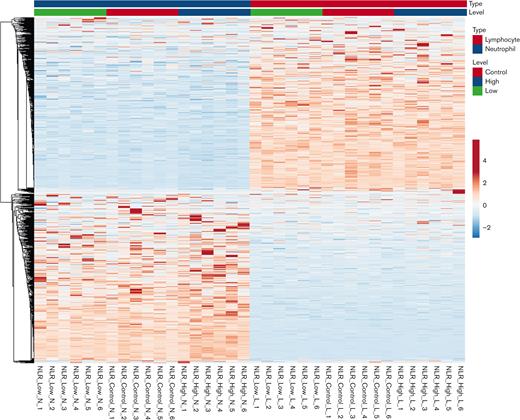 Whole transcriptome of RNA from neutrophils and lymphocytes collected from patients with NLR, high (NLR_High), low (NLR_Low), or control (NLR_Control). The “N” or “L” letter code in the sample name means that either neutrophils or lymphocytes were the source of the RNA. There were 6 patients within each category. Blue=reduced level of expression; red=high level of expression.
