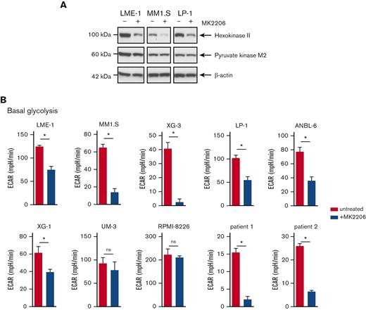AKT inhibition suppresses glycolysis and OXPHOS in MM cells. (A) Immunoblot analysis of HK2 and PKM2 in LME-1, MM1.S, and LP-1 HMCLs treated overnight with 2.5 μM MK2206 AKT inhibitor or left untreated. β-actin served as a loading control. (B) Basal glycolysis in HMCLs and MMPCs (n = 2 patients) treated with 2.5 μM MK2206 (blue bars) for 20 hours or untreated (red bars). Basal ECAR values from the Seahorse XF glycolysis stress test are depicted, and means ± SEM are shown (t test, n = 5-6 measurements). (C) Basal respiration and spare respiratory capacity in HMCLs and MMPCs (n = 2 patients) treated with 2.5 μM MK2206 (blue bars) or untreated (red bars) for 20 hours. OCR values from the Seahorse XF mitochondrial stress test are depicted, and means ± SEM are shown (t-test, n = 5-6 measurements).t test, ∗P < .05; MMPC, primary MM plasma cells.
