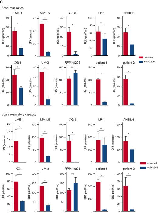 AKT inhibition suppresses glycolysis and OXPHOS in MM cells. (A) Immunoblot analysis of HK2 and PKM2 in LME-1, MM1.S, and LP-1 HMCLs treated overnight with 2.5 μM MK2206 AKT inhibitor or left untreated. β-actin served as a loading control. (B) Basal glycolysis in HMCLs and MMPCs (n = 2 patients) treated with 2.5 μM MK2206 (blue bars) for 20 hours or untreated (red bars). Basal ECAR values from the Seahorse XF glycolysis stress test are depicted, and means ± SEM are shown (t test, n = 5-6 measurements). (C) Basal respiration and spare respiratory capacity in HMCLs and MMPCs (n = 2 patients) treated with 2.5 μM MK2206 (blue bars) or untreated (red bars) for 20 hours. OCR values from the Seahorse XF mitochondrial stress test are depicted, and means ± SEM are shown (t-test, n = 5-6 measurements).t test, ∗P < .05; MMPC, primary MM plasma cells.