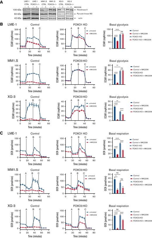 AKT regulates glycolysis and OXPHOS in a FOXO-dependent fashion in MM cells. (A) Immunoblot analysis of HK2 and PKM2 expression in LME-1, MM1.S, and XG-3 Cas9-CTRL clones CTRL and FOXO KO clones (FOXO1 for LME-1, and FOXO3 for MM1.S and XG-3) treated overnight with 2.5 μM MK2206 or left untreated. β-actin served as a loading control. (B) Seahorse XF glycolysis stress test profiles of CTRL clones (left panels, n = 2), and FOXO knockout clones (middle panels, n = 2) treated for 20 hours with 2.5 μM MK2206 (red lines) or left untreated (blue lines). Means ± SEM of ECAR values are depicted (n = 5 measurements for each clone) and Seahorse XF injections are shown: glucose (=A), oligomycin (=B), 2-DG (=C). Bar graphs (right panels) depict basal glycolysis values, means ± SEM are shown (one-way ANOVA, with Bonferroni multiple comparison test). (C) Seahorse XF mitochondrial stress test profiles of CTRL clones (left panels, n = 2), and FOXO KO clones (middle panels, n = 2) treated for 20 hours with 2.5 μM MK2206 (blue lines) or left untreated (red lines). Means ± SEM of OCR values are depicted (n = 5 measurements for each clone) and Seahorse XF injections are shown: oligomycin (=A), FCCP (=B), rotenone and antimycin A (=C). Bar graphs (right panels) depict basal respiration values, and means ± SEM are shown (one-way ANOVA, with Bonferroni multiple comparison test, ∗∗∗∗P < .0001, ∗∗∗P < .001, ∗∗P < .01, ∗P < .05; ns = not significant.