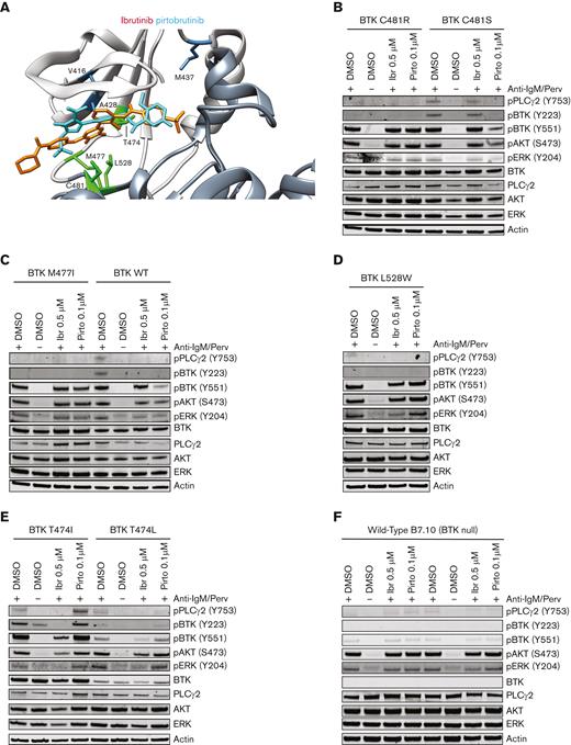 BTK gatekeeper mutations T474I and T474L, but not other observed BTK mutations, can activate proximal BCR signaling. (A) Model of human BTK kinase domain binding modes of covalent inhibitor ibrutinib (orange) and noncovalent inhibitor pirtobrutinib (cyan). Upper domain is in light gray and lower domain is in dark gray. (B-E) B7.10 cells (DT40 cells lacking endogenous BTK) were transfected with BTK C481R, BTK M477I, BTK L528W, T474I BTK, T474L BTK, or C481S BTK, or WT BTK as a control. Cells were starved in medium not supplemented with serum 36 hours after transfection, and treated with 0.1 μM pirtobrutinib for 2.5 hours, or 0.5 μM ibrutinib or DMSO for 1 hour. Subsequently, the samples were washed with medium not supplemented with serum 3 times and activated with medium containing pervanadate and mouse antichicken IgM. Representative western blots are shown in panels B-E. Quantification of phospho-BTK, phospho-PLCγ2, phospho-AKT, and phospho-ERK is in supplemental Figure 8. (F) Untransfected (WT B7.10) cells were treated with the indicated doses of the drugs for 1 hour and activated with pervanadate and mouse antichicken IgM–containing medium. Results from duplicate experiments are shown in panel F.