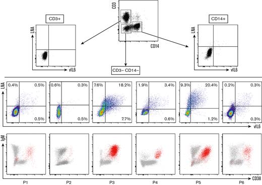 Identification of circulating KIV during KSHV-MCD flare using LNA/vIL-6 flow-FISH. Flow-FISH was performed on the peripheral blood of 6 patients with confirmed KSHV-MCD flare. LNA+ and/or vIL-6+ cells are represented among CD3+ (T cells), CD14+ (monocytes), and CD3−CD14− cells. Values are given as percentages of positive cells among CD3−CD14− cells. LNA+ and/or vIL-6+ cells are depicted in red in an IgM/CD38 dot plot for each patient, showing that most of the infected cells are IgM+ and CD38+ cells.