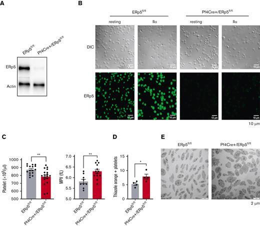 Deletion of ERp5 in the megakaryocyte lineage results in mild macrothrombocytopenia. (A) Western blot of ERp5 in resting platelet lysates from control (ERp5fl/fl) and CKO (Pf4Cre+/ERp5fl/fl) mice, demonstrating ERp5 deletion in platelets. (B) Immunostaining of ERp5 in platelets from control and CKO mice after their adhesion to fibrinogen, without (resting) or with stimulation with thrombin (IIα). Differential interference contrast (DIC) (top) and staining with an anti-ERp5 Alexa 488 antibody (bottom). Representative images, n = 2 per genotype. (C) Peripheral platelet count and mean platelet volume (MPV) in control (gray column) and CKO mice (red column), n = 16 to 18 mice per genotype. (D) Percentage of reticulated (thiazole orange–positive) platelets in control and CKO mice. (E) Ultrastructure of resting platelets isolated from control and CKO mice. Representative TEM images showing increased platelet size in CKO mice. n = 4 mice per genotype for thiazole orange staining and TEM, mean ± standard error of the mean (SEM), Student t test. ∗P < .05, ∗∗P < .005. Scale bar, 10 μm (B) and 2 μm (E).